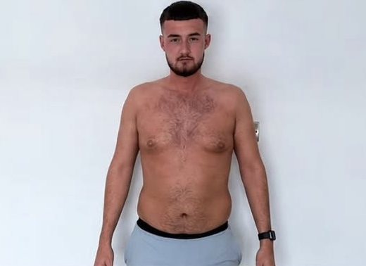 Karl before